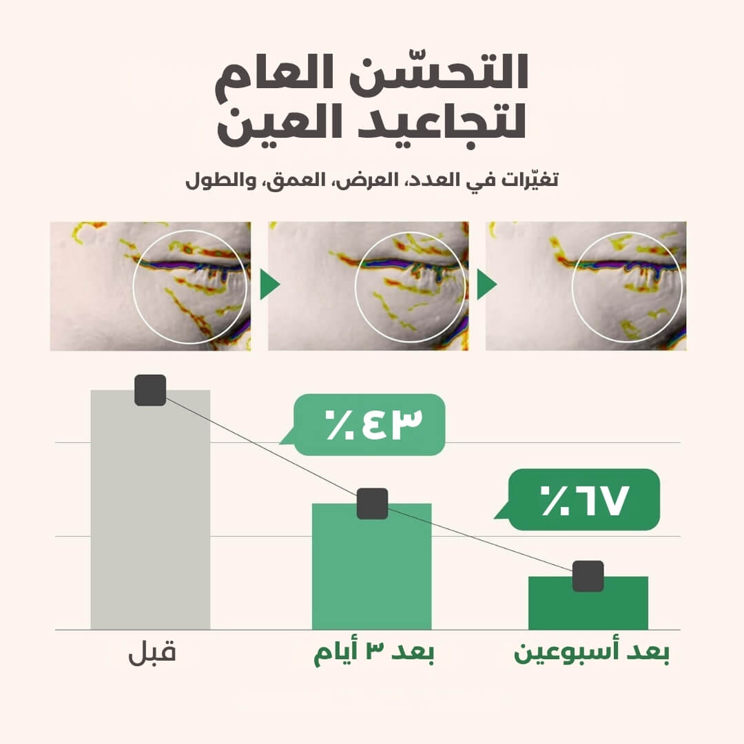 سيروم العيون بالكولاجين النباتي (مع أداة التدليك الباردة)