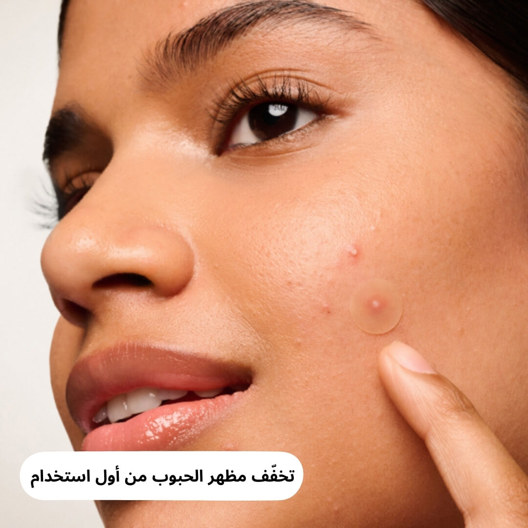 لاصقات حبوب Undo الأصلية